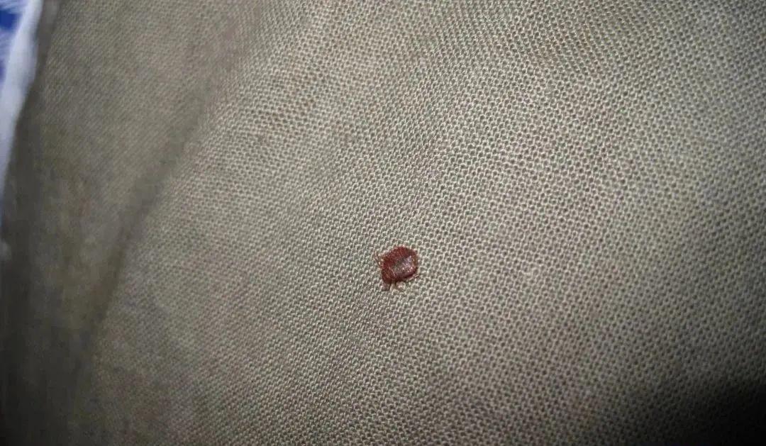 灭臭虫效果最好的药_如何灭臭虫_灭臭虫公司费用