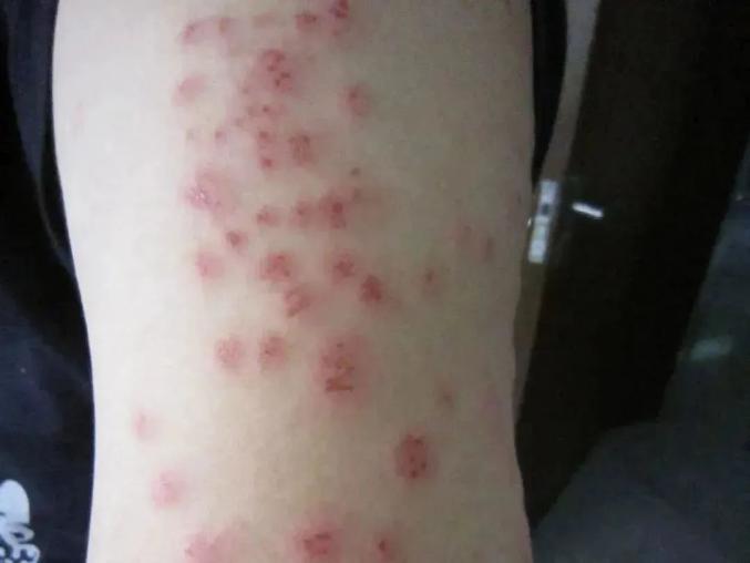 如何灭臭虫_灭臭虫效果最好的药_灭臭虫公司费用